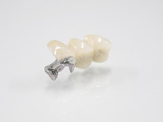 メタルボンド①